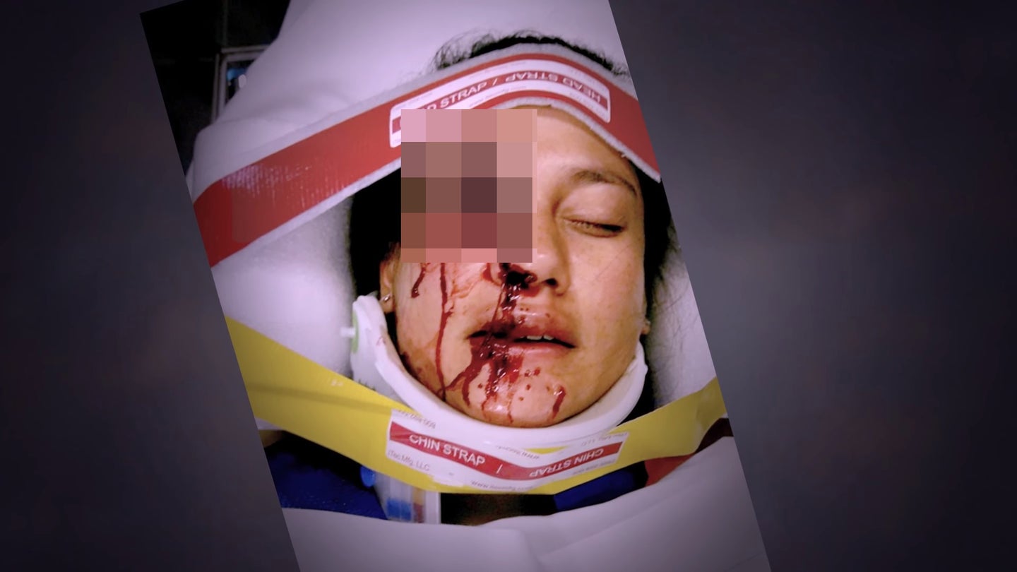 Honda Makes Graphic Safety Video To Scare You Into Fixing Your Defective Takata Airbag