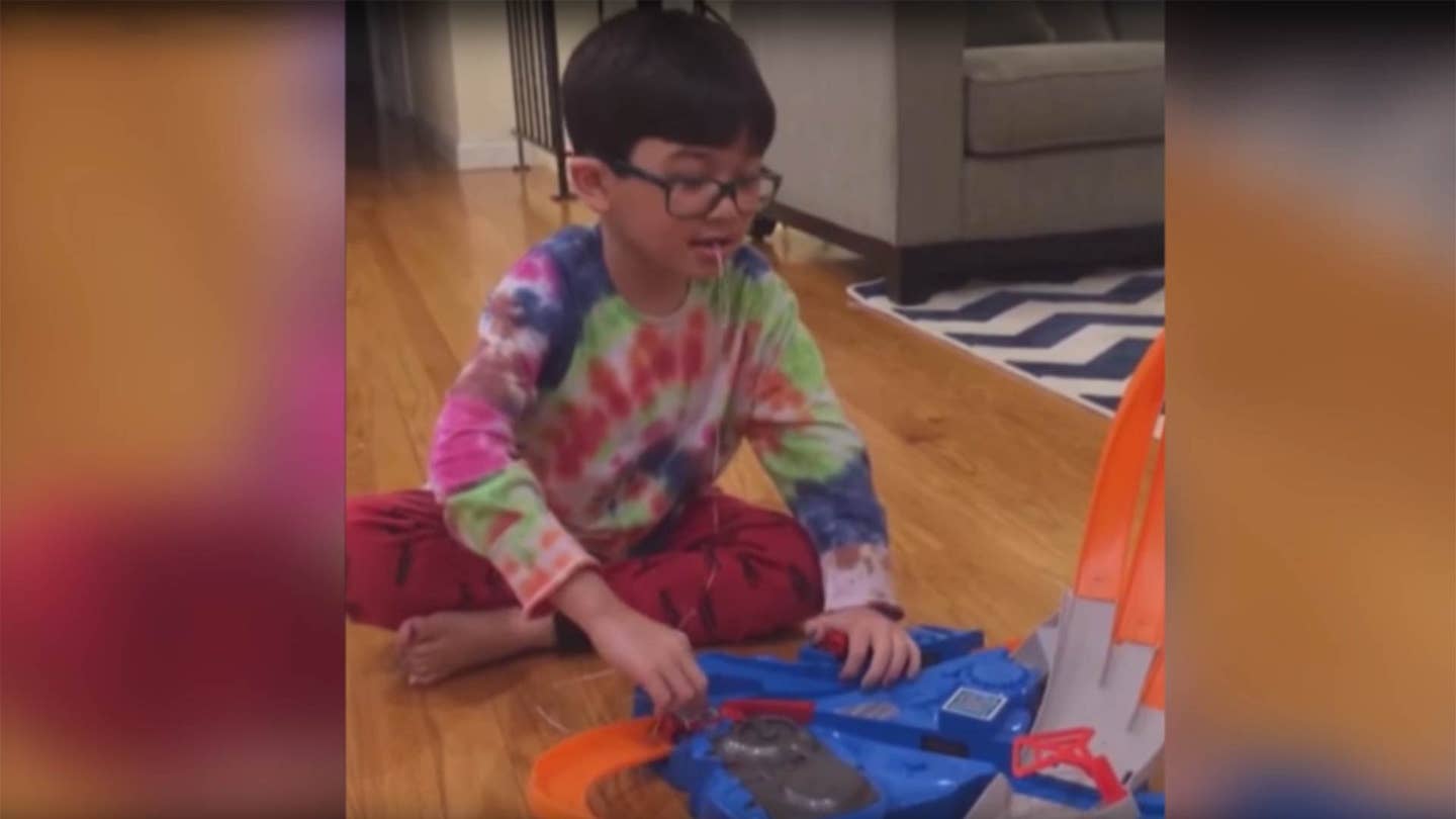 Watch a Kid Use Hot Wheels to Pull Tooth