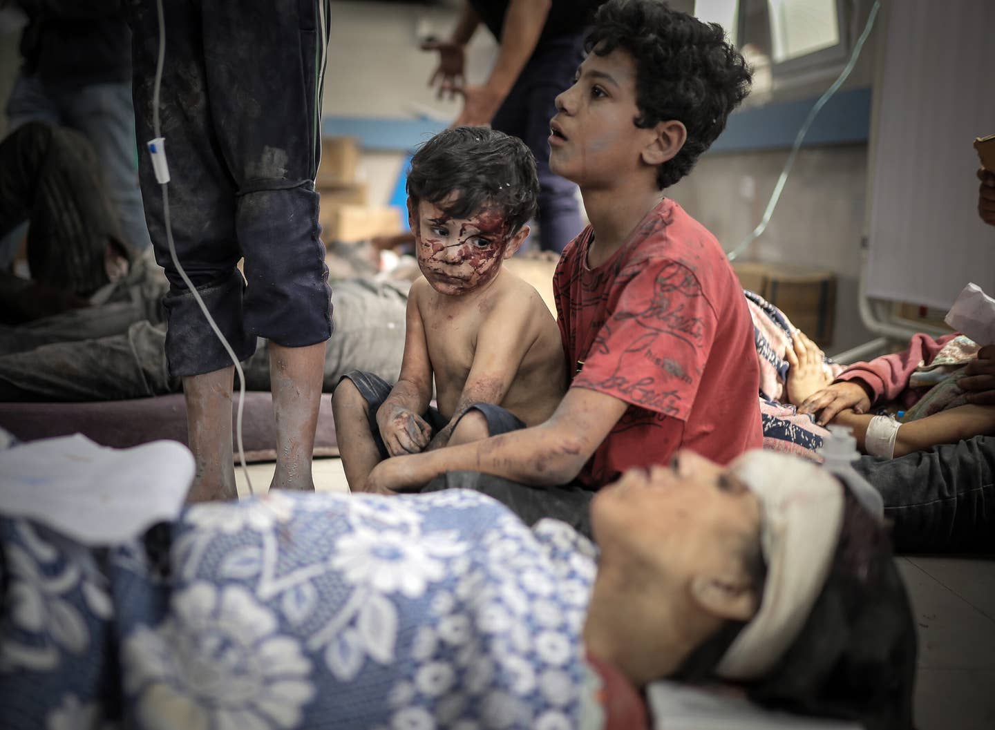 Lidé zranění po izraelských útocích jsou převezeni do nemocnice Al-Shifa, zatímco izraelské útoky pokračují 17. den střetů ve městě Gaza v Gaze 23. října 2023. (Foto Belal Khaled/Anadolu přes Getty Images)